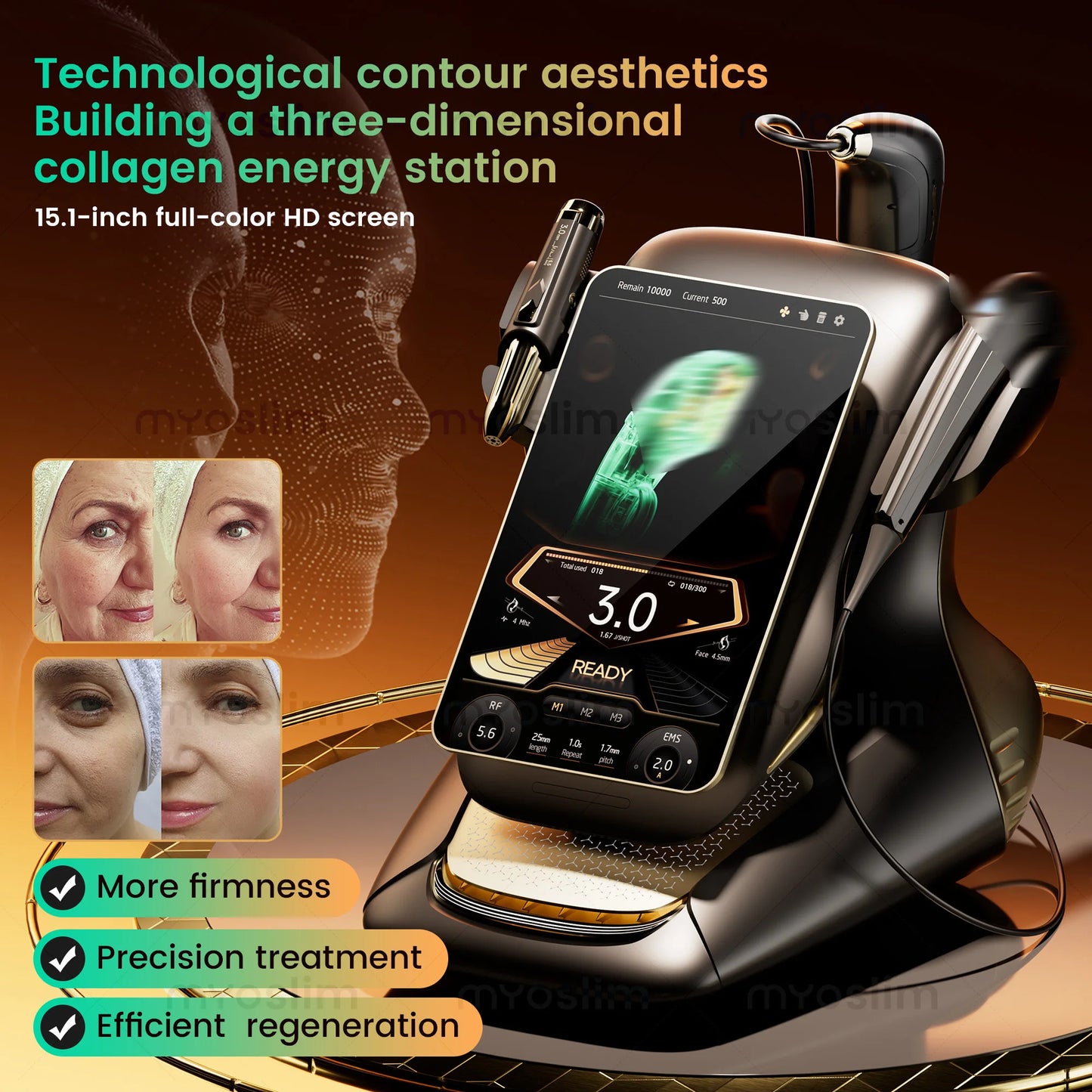 Professional beauty Equipment Machine 25D hifu 360MAX for Face Lifting Slimming and Fat Reduction Latest Model for beauty salon